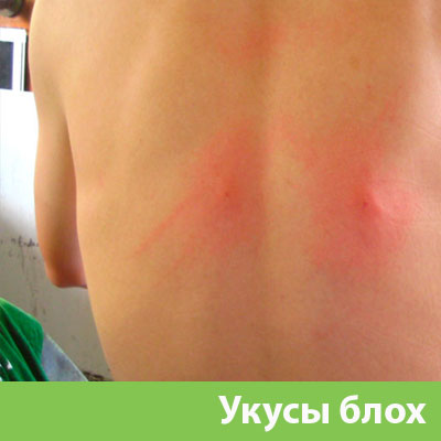 Укусы блох в Воскресенске